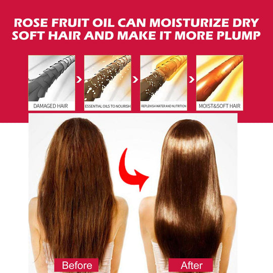 Rosehip Face, Body &amp; Hair Oil