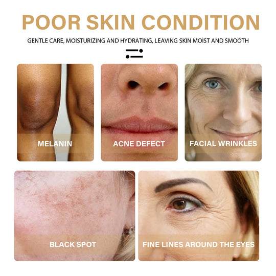 Turmeric Dark Spot Correcting Facial Serum