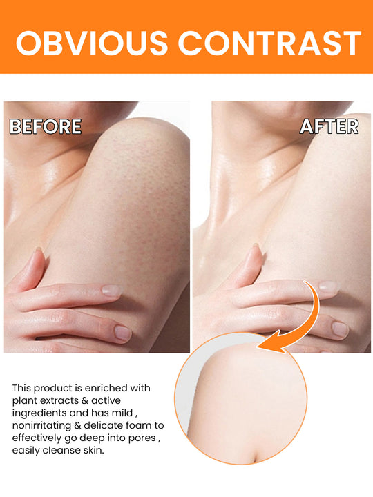 Turmeric Face &amp; Body Dark Spot Serum
