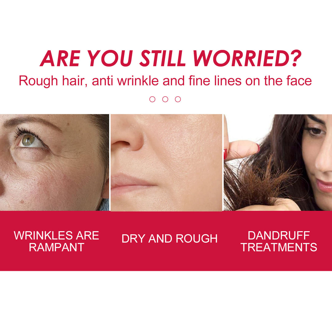 Rosehip Face, Body &amp; Hair Oil