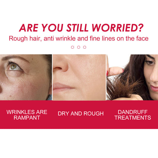Rosehip Face, Body &amp; Hair Oil