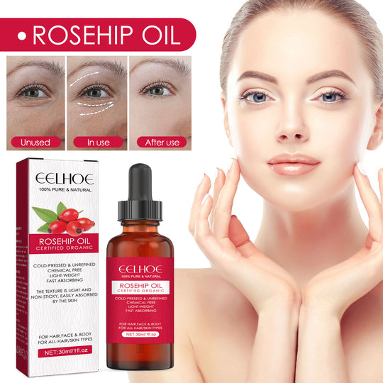 Rosehip Face, Body &amp; Hair Oil